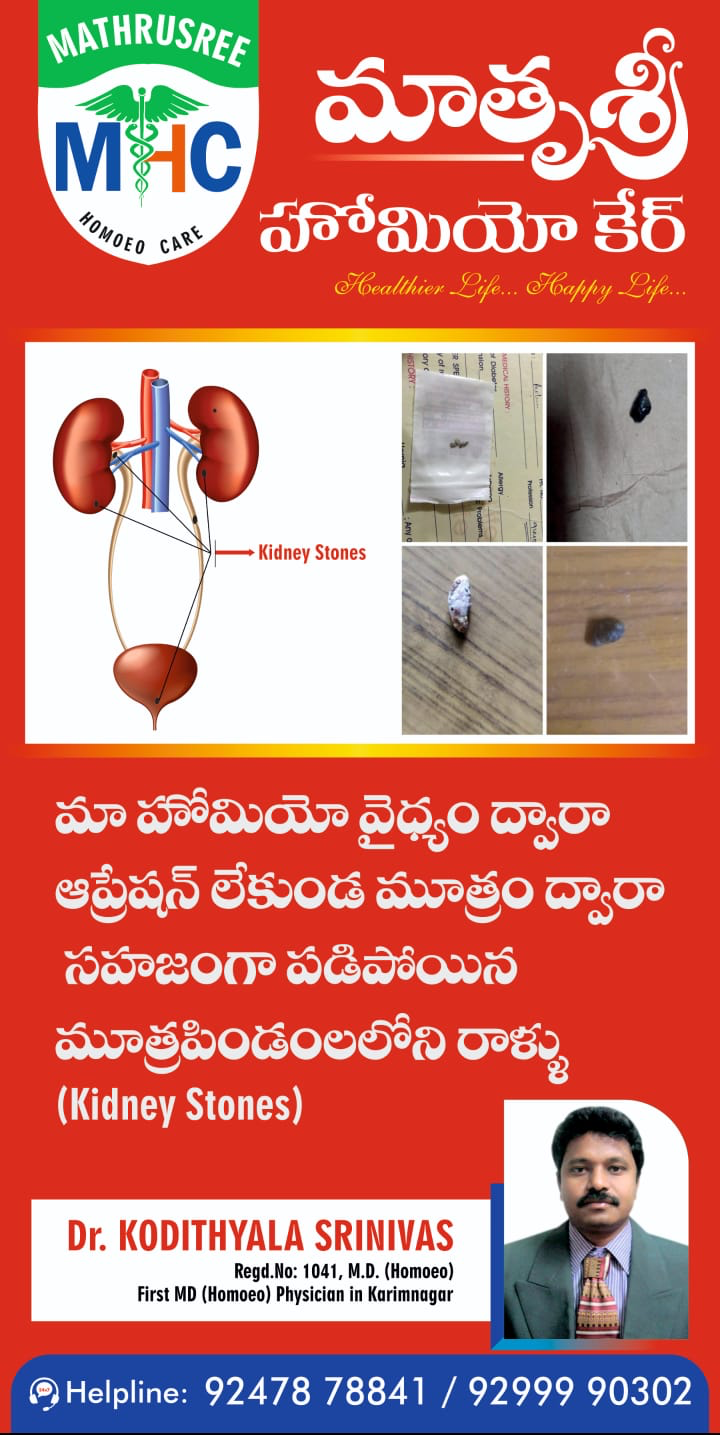 Kidney stones without surgery